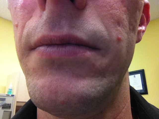 Photo of man's shaved face